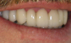 Bright, white teeth that are perfectly straight