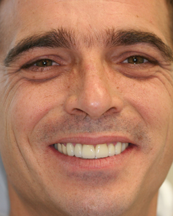 Closeup of a early 40s man with great teeth