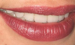 Smiling woman's straight, white teeth